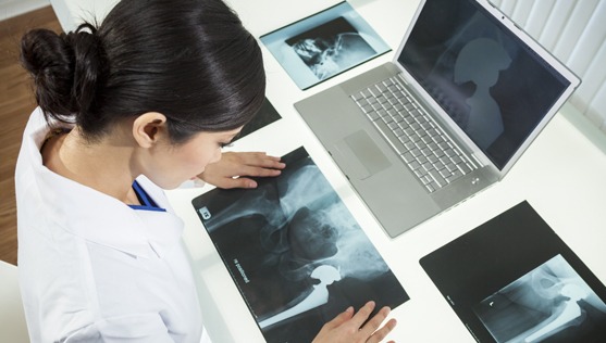 woman doctor with laptop looking at x-ray